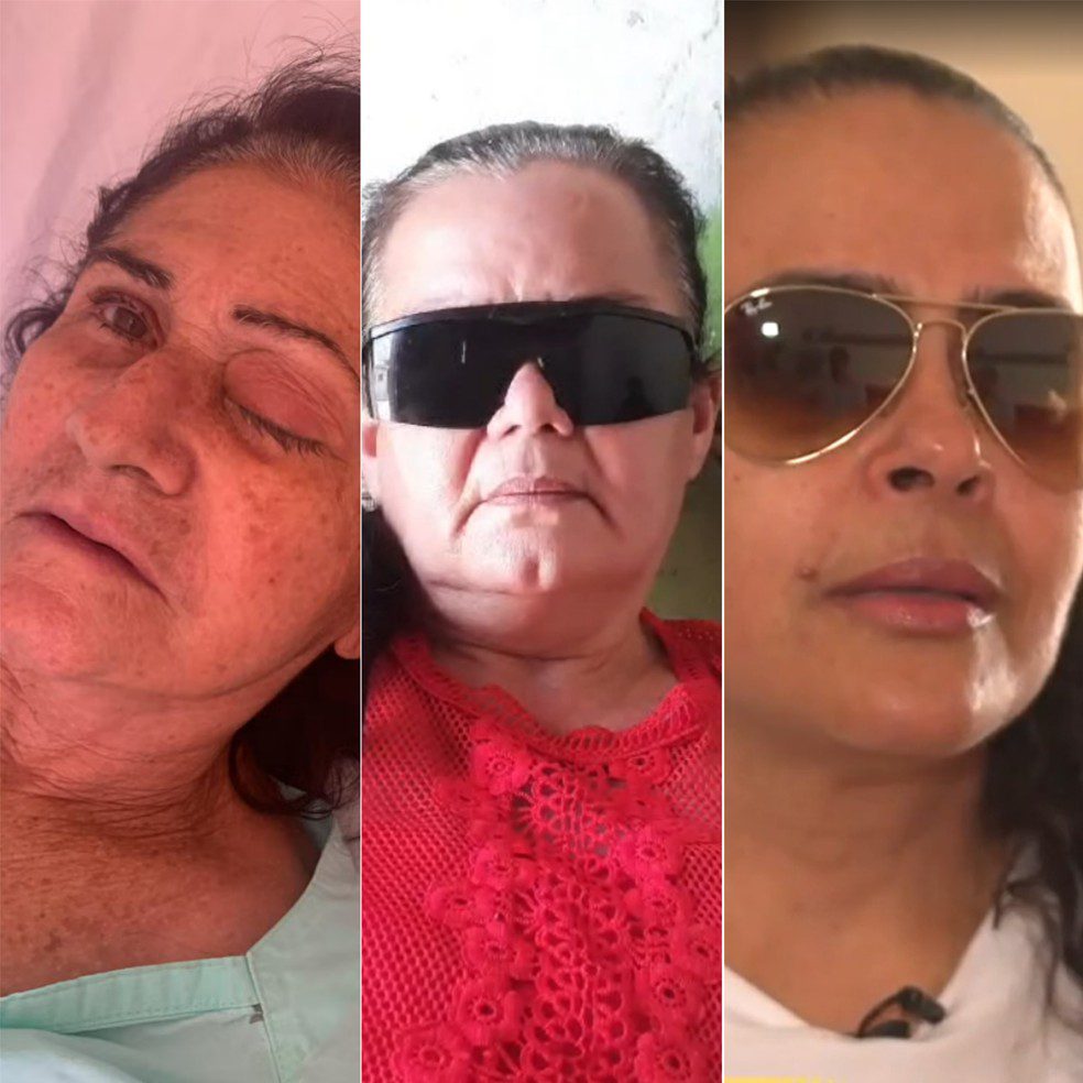 PREFEITO DE PARELHAS DIZ QUE JÁ COMEÇOU A INDENIZAR PACIENTES INFECTADOS EM MUTIRÃO DE CATARATAS