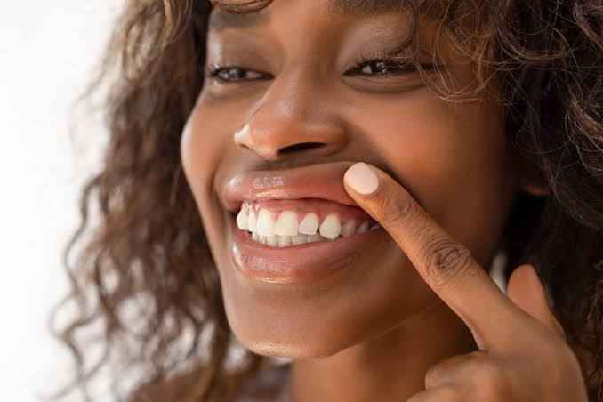 JAPÃO COMEÇA A TESTAR MEDICAMENTOS QUE PODEM FAZER DENTES CRESCEREM DE NOVO